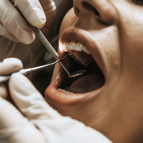 parodontologia Civitali Milano