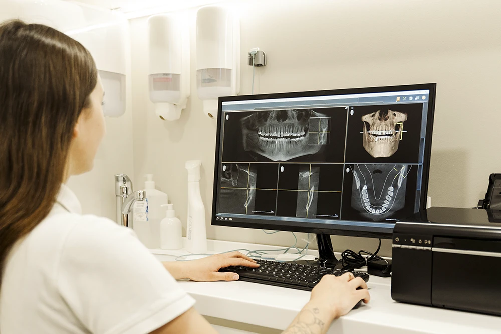 scansioni CBCT