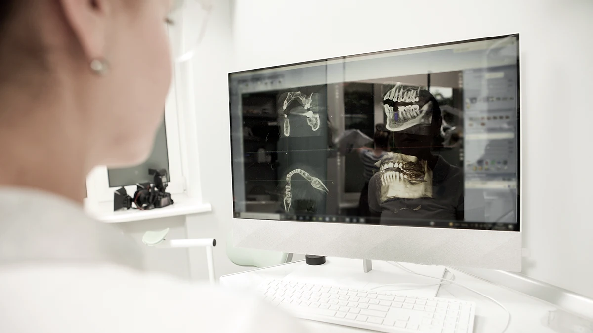 CBCT