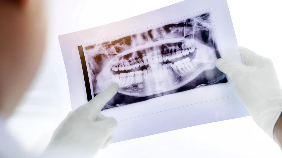 denti del giudizio